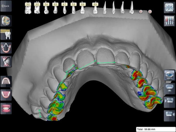 DEMO Europe: SimplyCeph shows powerful medical iPad app